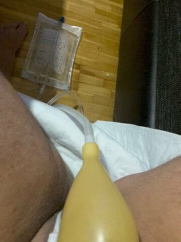 pees in my catheter4