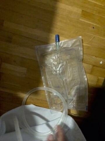 pees in my catheter 1